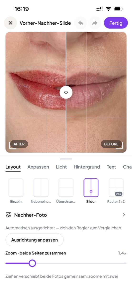 Der Vorher-Nachher-Editor mit ausgewähltem Slider-Layout